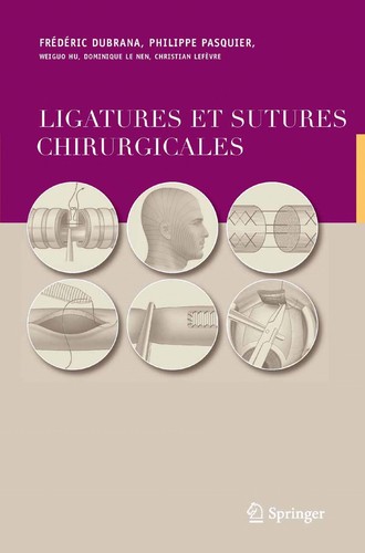 Ligatures et sutures chirurgicales: Techniques chirurgicales