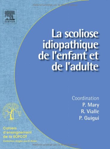La scoliose idiopathique de l'enfant et de l'adulte