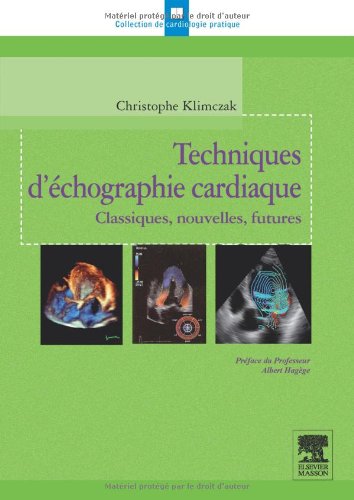 Techniques D'échographie Cardiaque: Classiques, Nouvelles, Futures