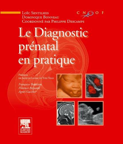 Le diagnostic prénatal en pratique