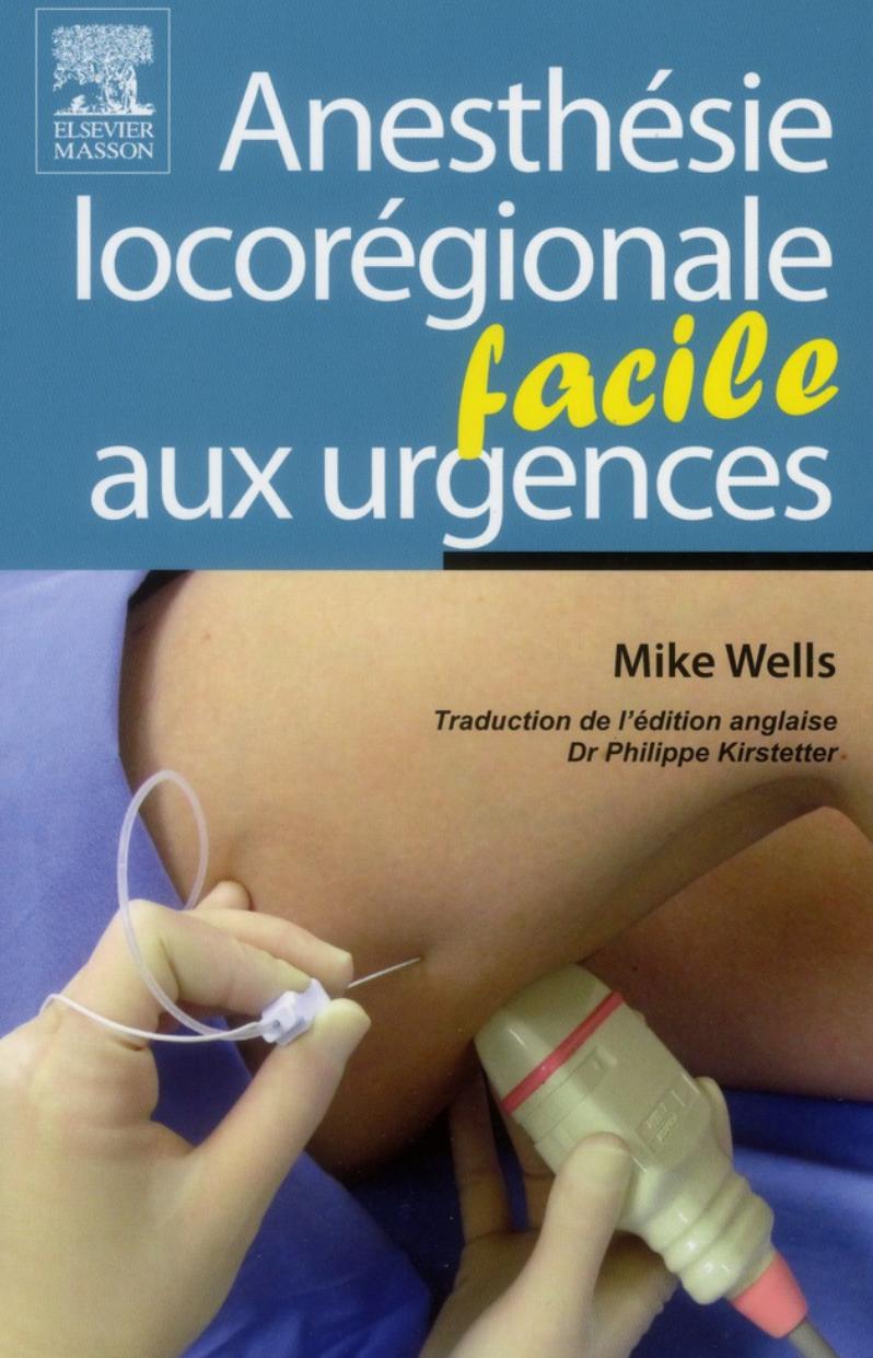 Anesthesie locoregionale facile aux urgenc