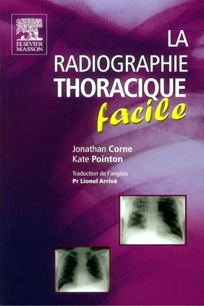 La radiographie thoracique facile
